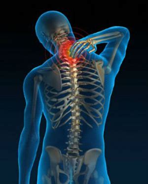 как да се лекува остеохондроза на гимнастиката на шийния гръбнак